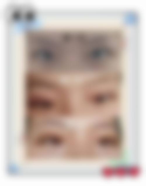 泰安第一人民医院整形美容外科中 心特色项目及技术优势