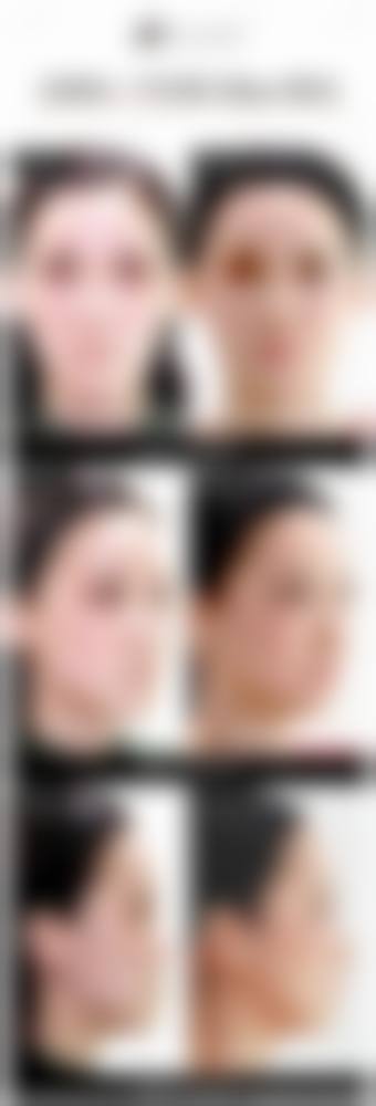 赤峰紫洁叶子整形医疗美容诊所真人口碑评价怎么样?