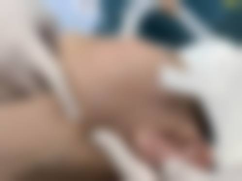 海口韩秀医疗美容门诊部真人口碑评价怎么样？