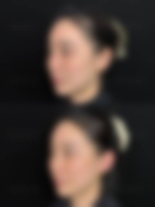 面部提升项目价格