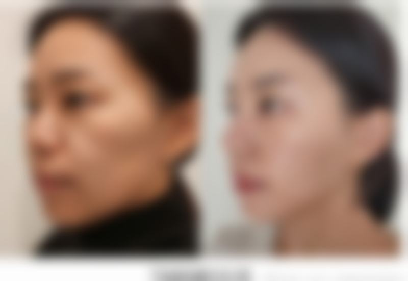 青岛韩松哲医疗整形详细的预约挂号方式及流程