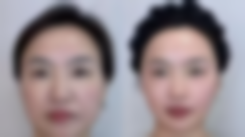 赣州曙光整形医疗美容门诊部详细的预约挂号方式及流程