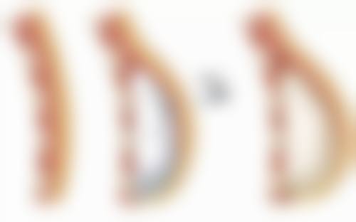 其他去除方法:多种途径告别眼袋和黑眼圈