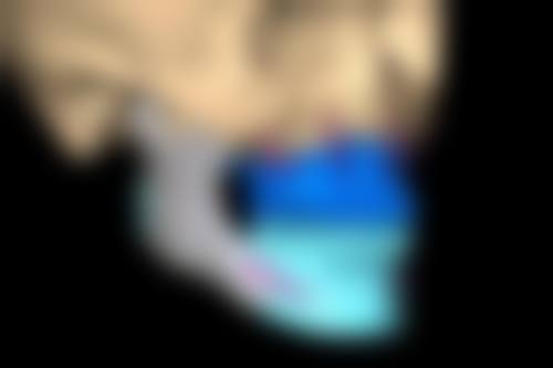 三张图精细判断方法