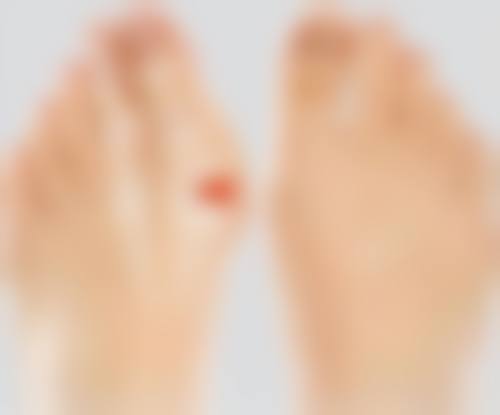 饮食调理：从内部改善眼部问题