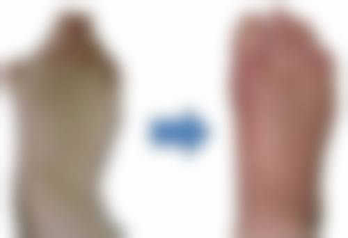 适用情况:冰敷在哪些情况下有用