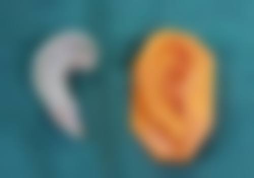 武汉博爱整形医疗美容医院真人口碑评价怎么样？