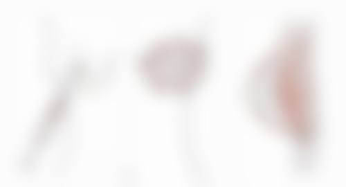 冰敷能去眼袋和黑眼圈吗？不能，但能缓解浮肿！试试6800元微创祛眼袋或纳米无痕祛眼袋！ 