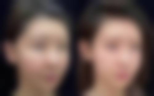 局部护理：呵护眼周肌肤的秘诀