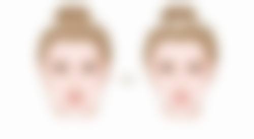 手术费用及性价比：合理消费追求美丽