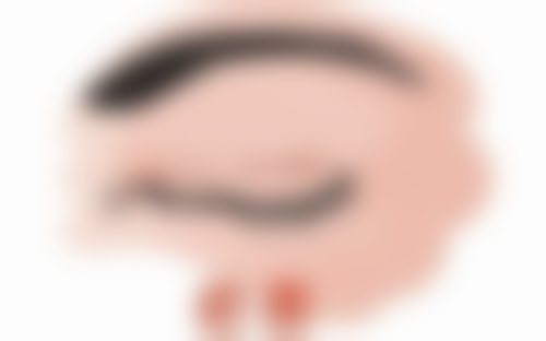 不同类型擦伤疤痕变淡时间大对比