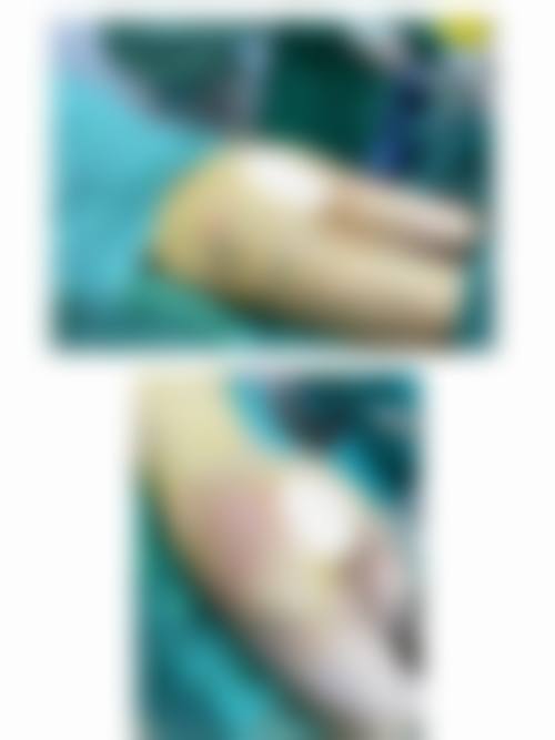 威海大西医疗美容诊所真人口碑评价怎么样？