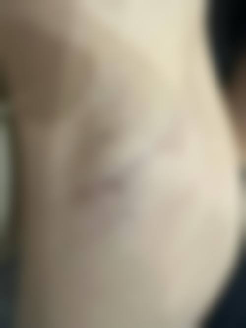 上海茸城女子医院医学整形美容中 心真人口碑评价怎么样？