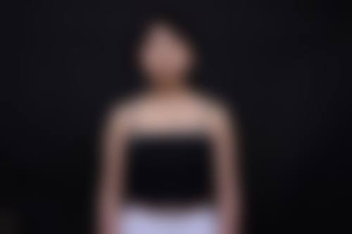 宜昌觅美整形医院真人口碑评价怎么样？