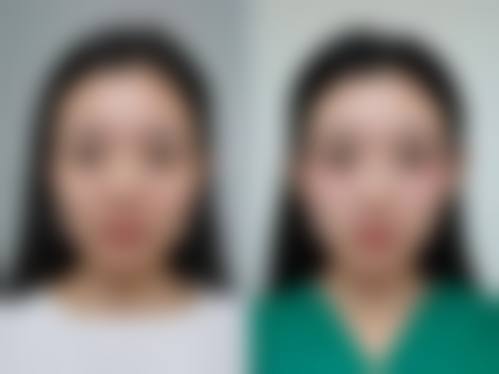 适应人群与优缺点