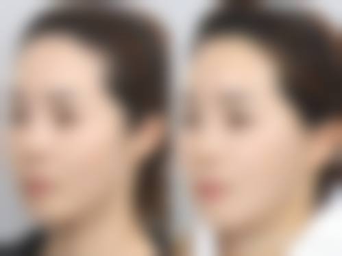 术后修复与维持时间