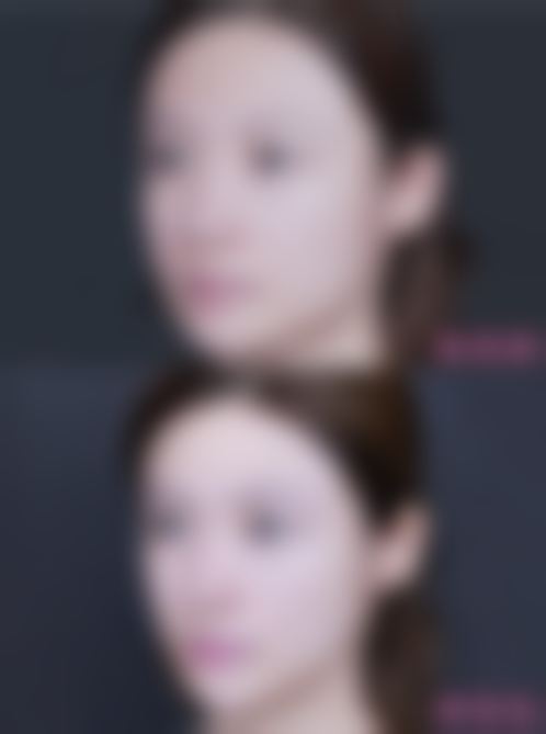 林莉医生技术优势