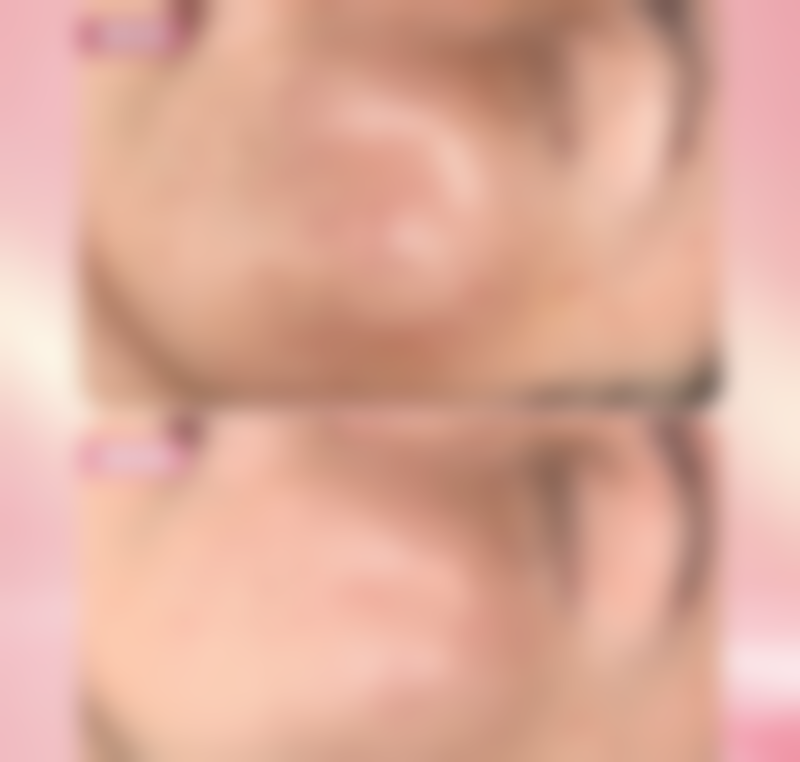 眼袋黑眼圈能淡化吗？能！调整作息、用丽珠兰白盒，还可做纳米无痕祛眼袋改善