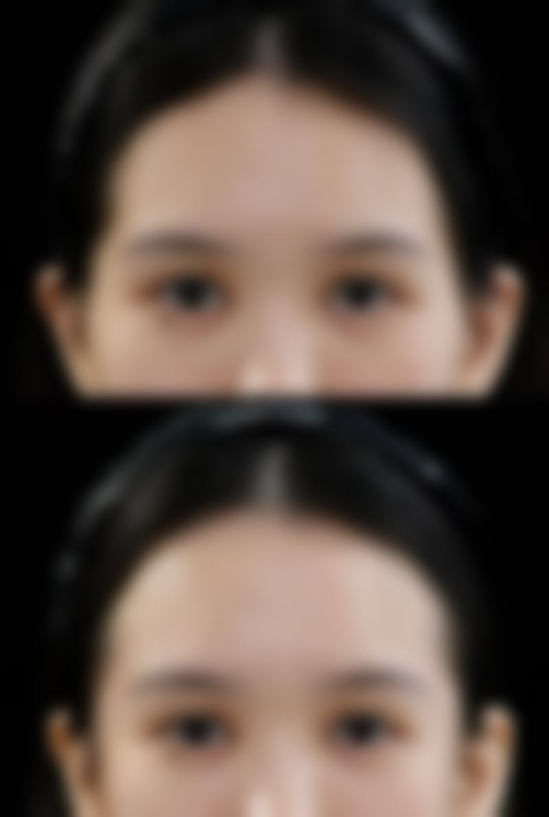 宜昌觅美整形医院收费价格表/收费标准