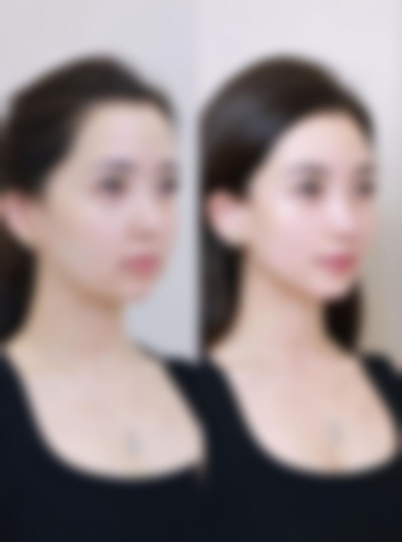 上海茸城女子医院医学整形美容中 心特色项目及技术优势