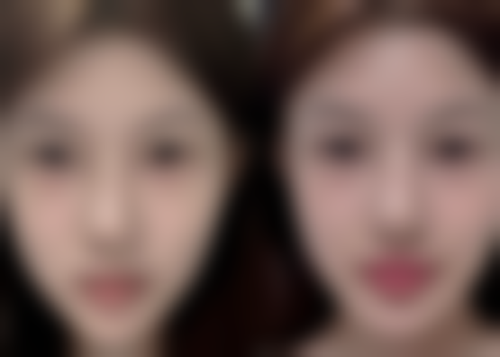 药物治疗:为疤痕瘙痒按下“暂停键”