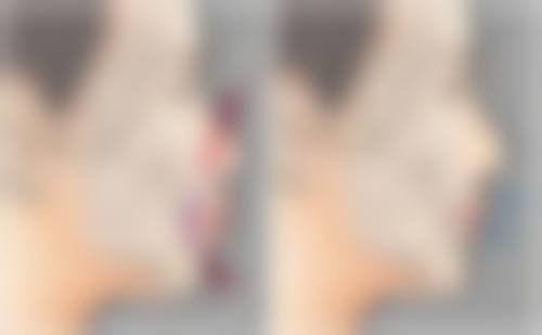 西安祛疤方案：性价比之选的祛疤之旅