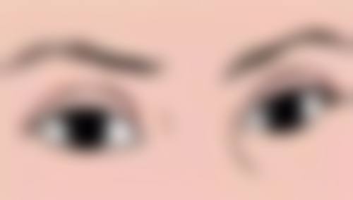 腰腹与小腿：联合抽脂的利与弊