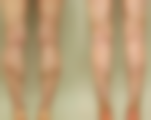 腹部与多部位：同时抽脂的条件与限制