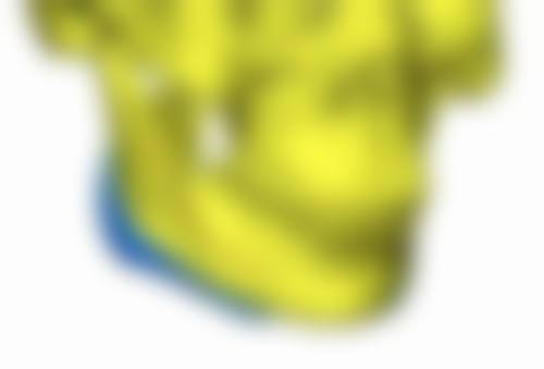 双眼皮手术做的太大能修吗？能！如北京丽星翼美魏志香等医生技术精湛，上万例成功修复案例为证！ 