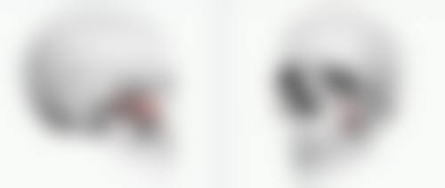 正确使用药物,抑制疤痕组织生成