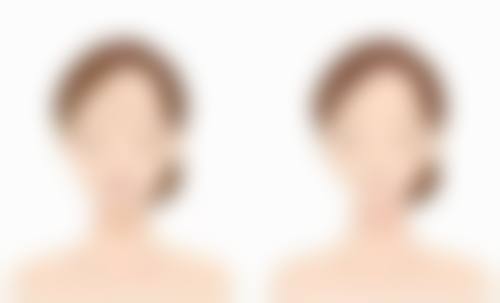 情绪波动大，不利于手术修复