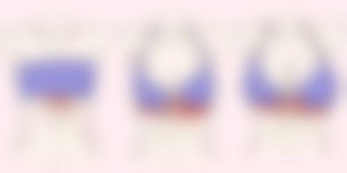 铂蕴：高端定制隆胸假体的出色之选