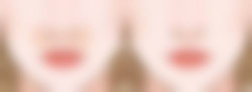 医美手段:快速去除眼袋黑眼圈