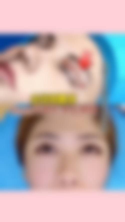 沈阳蒂美医疗美容诊所收费价格表/收费标准