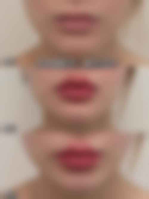 成都汉棠汉方医疗美容医院收费价格表/收费标准