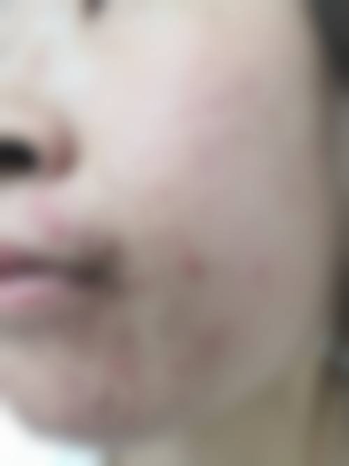 正规医院的更优方案