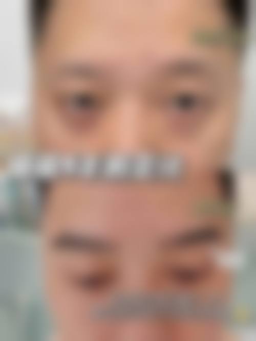 重庆唐森植发价格表详情