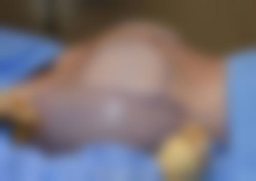 横滨中央美容外科收费价格表/收费标准