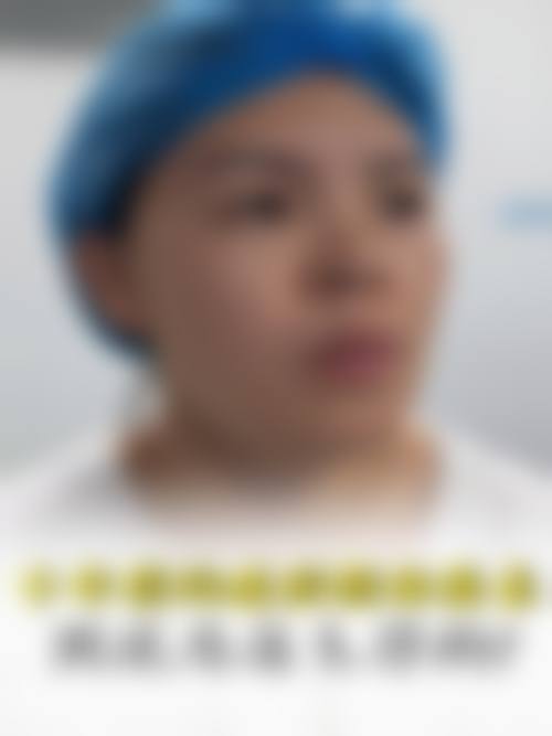 张丽杰医生口碑评价及真人实例