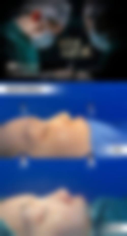 张丽杰医生技术优势