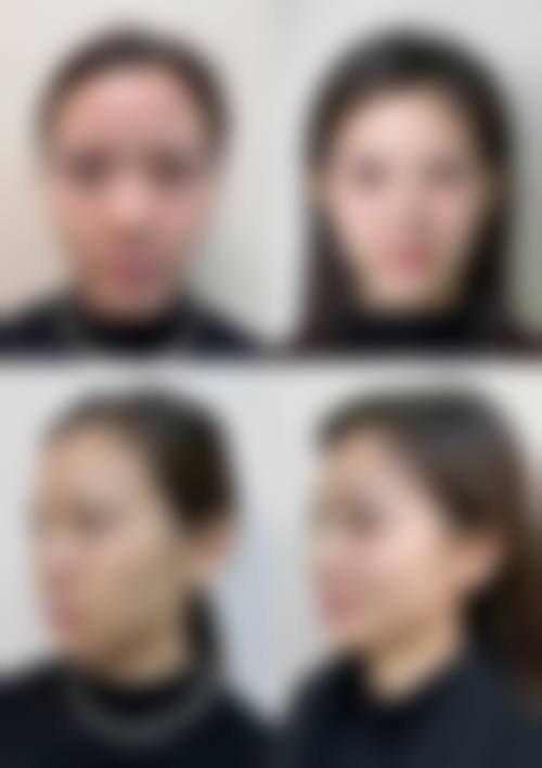 预约方式:便捷多样促变得更美