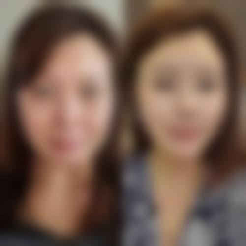 大庆彤铭整形医院收费价格表/收费标准