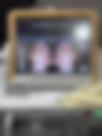 绝了！THE PRIDE整形医院迷你面部提升专属定制方案