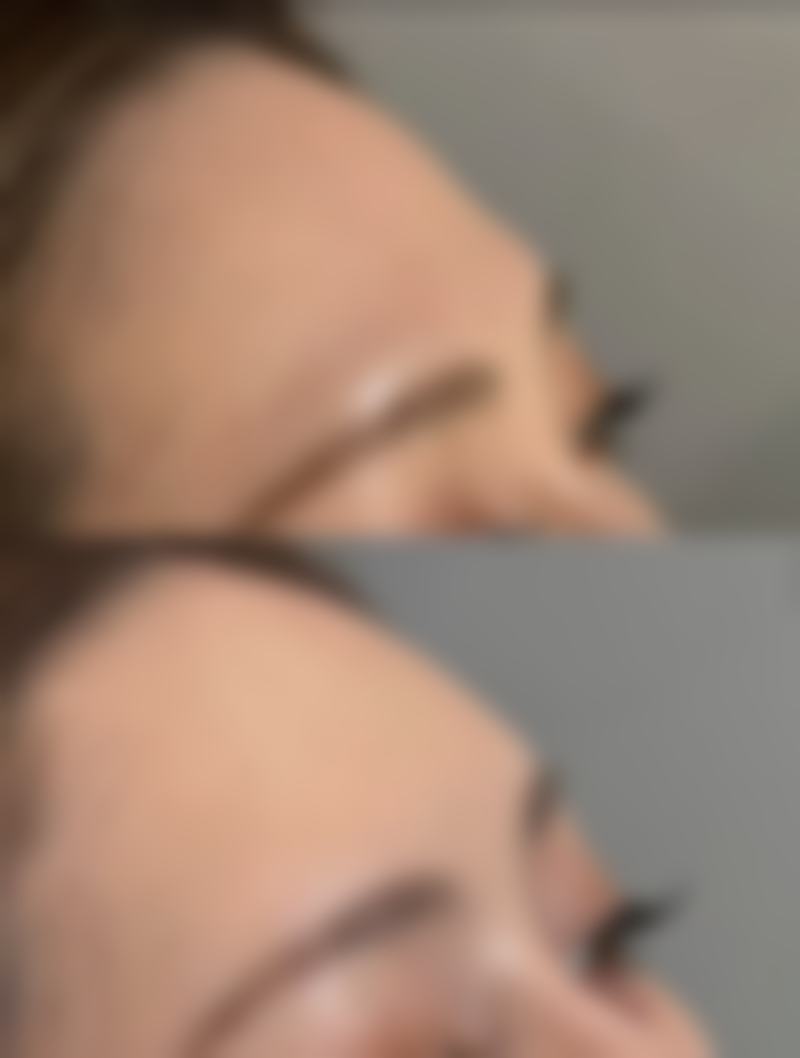 龙岩晶肤整形美容医院真人口碑评价怎么样？