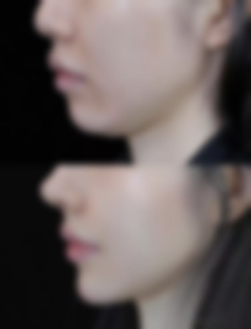 选择专精医院和医生的重要性