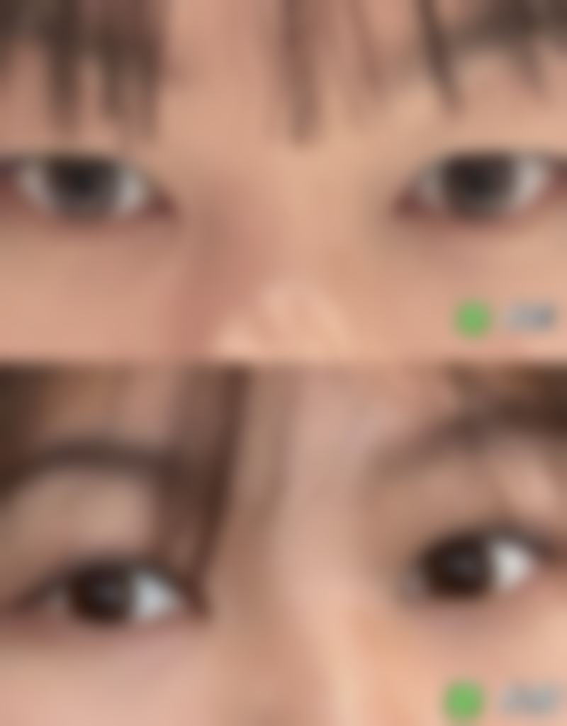 注意日常防护,避免外界不良刺激