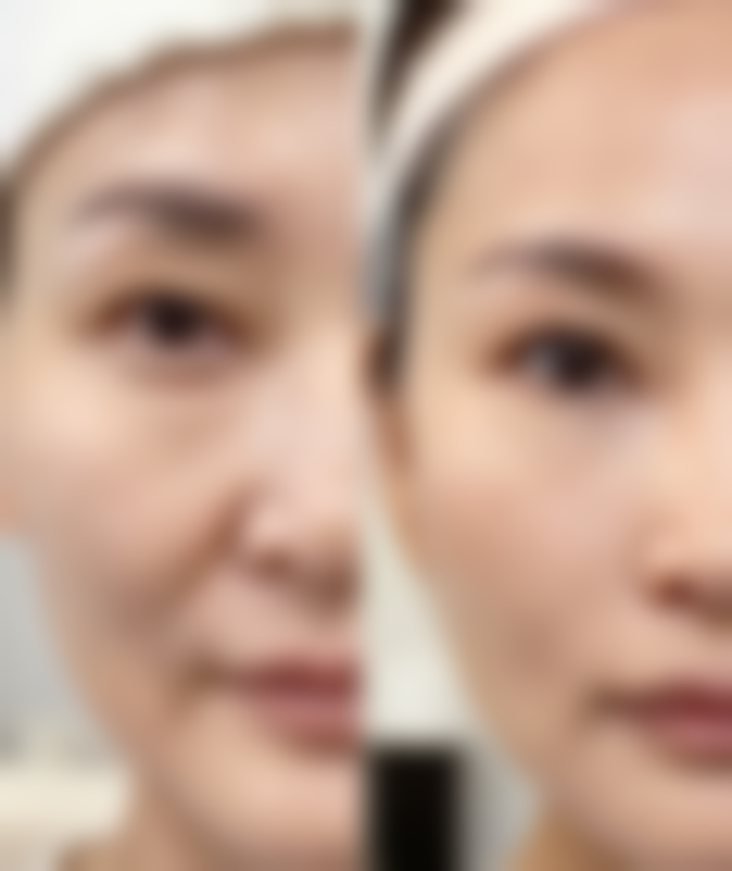 唇腭裂免费手术免费申请，需要注意什么？这份含多家医院及申请流程的攻略请收好！