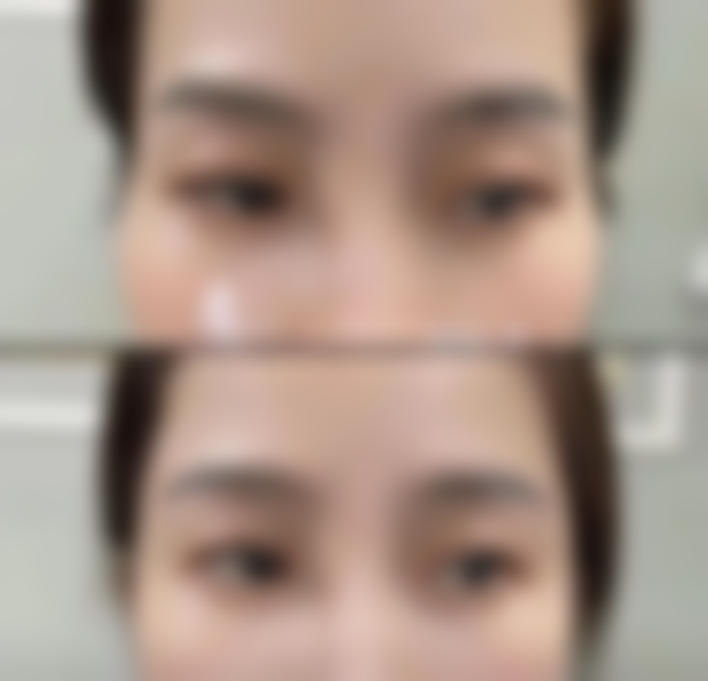 手术选择：综合考虑与医生沟通