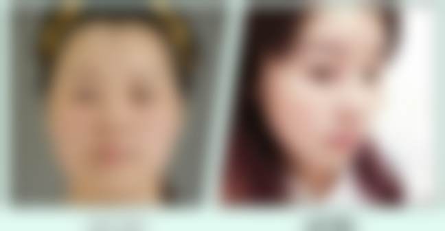 韦辉医生技术优势