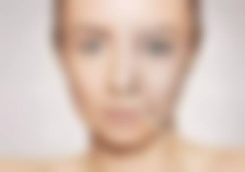 蒙石南医生:小切口拉皮骨干医生